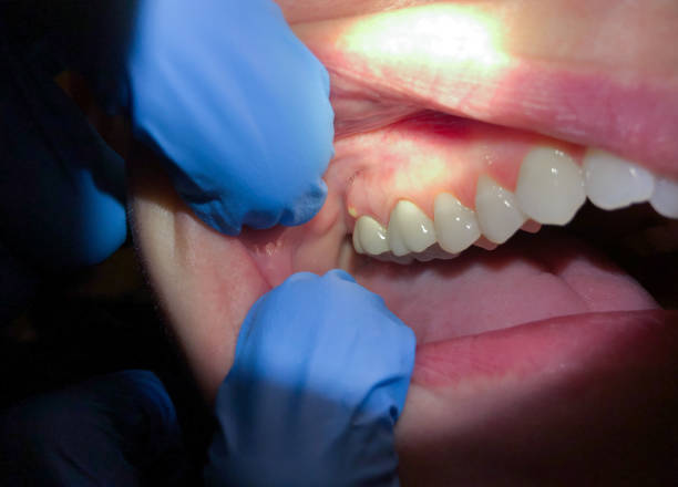 Emergency Dentist Open Today in NE